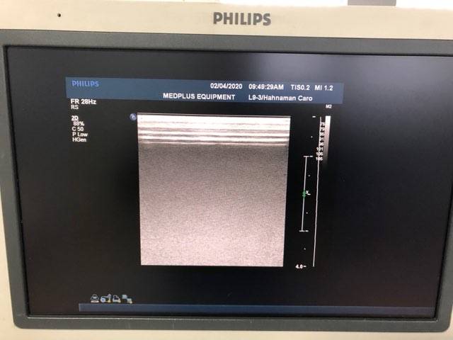 Philips iU22 Ultrasound Equipment DOM 2009